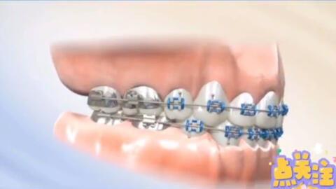 补牙齿视频国产 第2张 补牙齿视频国产 第2张